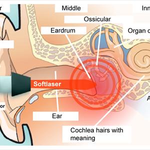 Clear Tinnitus Herbs - Hissing Sound In Ear - The Ringing In Your Ears May Not Be The Only Sounds You Hear